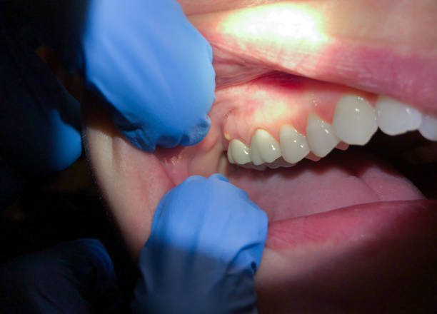 Best Emergency Cosmetic Dentistry in Evans City, PA