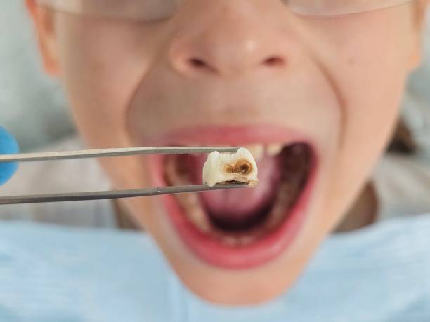 Best Emergency Dentist for Knocked-Out Tooth in Evans City, PA
